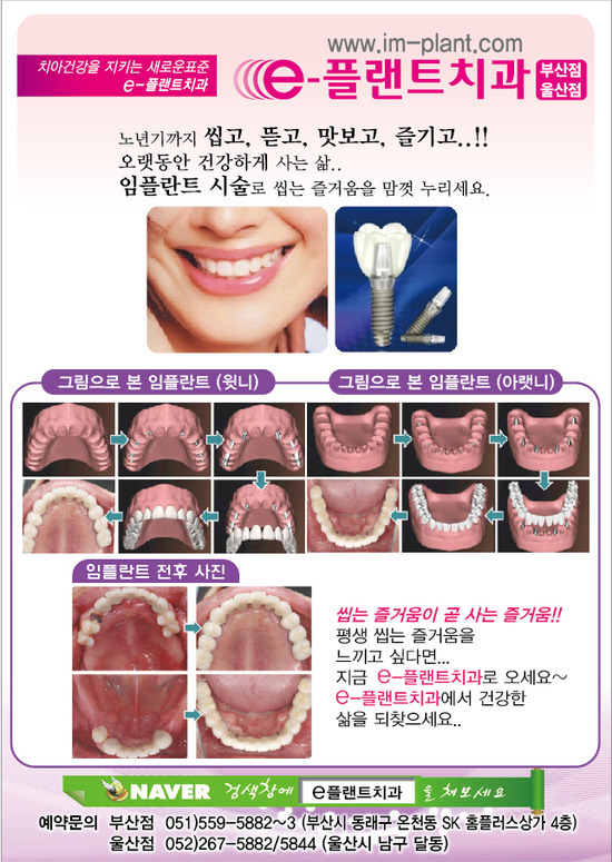 e-플랜트치과 이미지