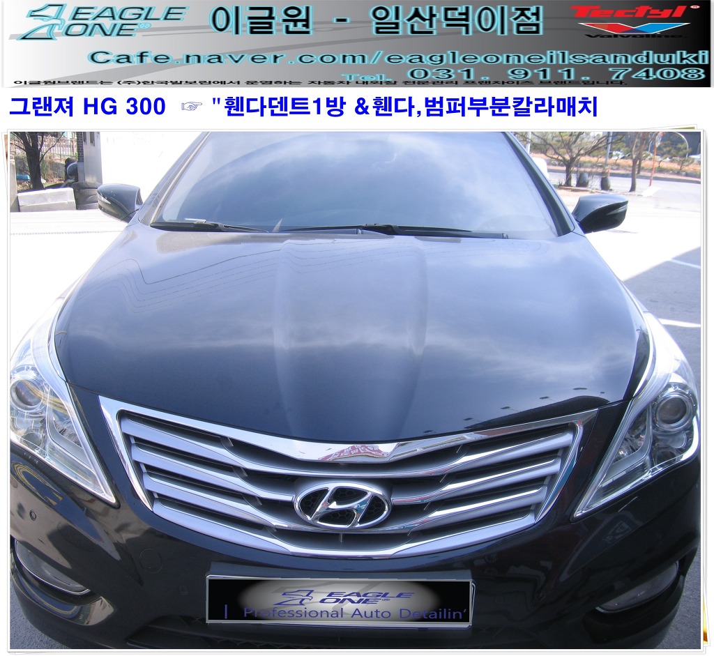 현대덴트칼라 이미지