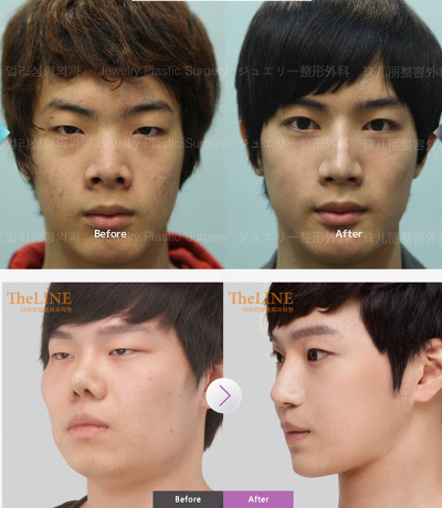 성형을 하는 이유 | 인스티즈