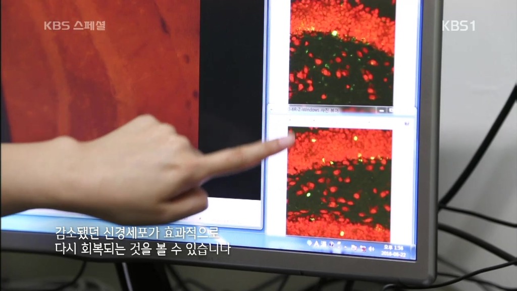 세계가 말하는 한의학과 동의보감 | 인스티즈