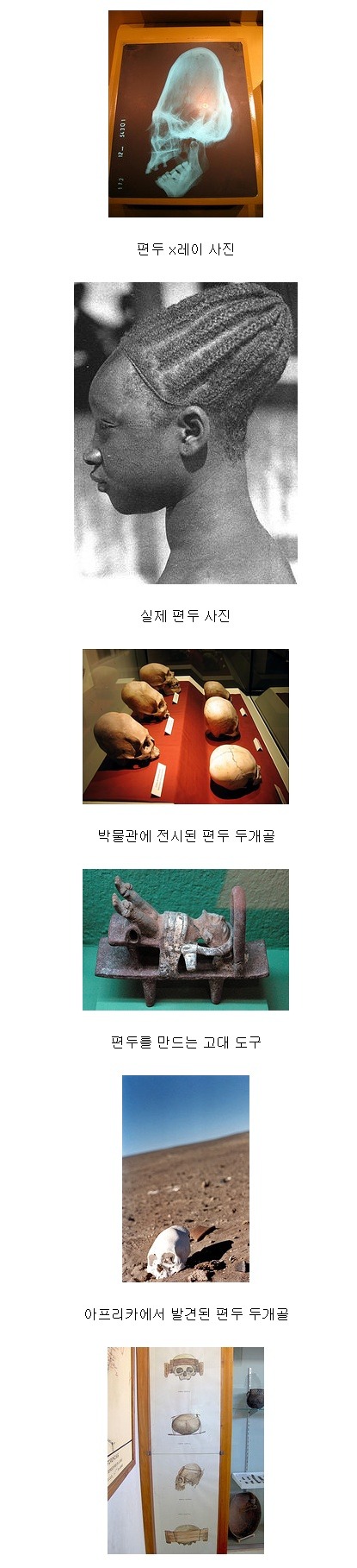 여자를 기형으로 만드는 세계 풍습들 | 인스티즈
