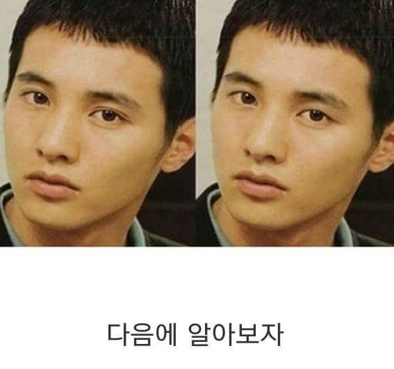 쌍커풀의 중요성에 대해 알아보자 | 인스티즈