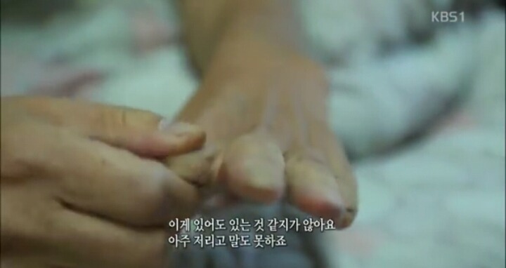 주의) 금연하는데 강한 자극을 주는 자료를 보고 싶으신 분만 클릭하세요 | 인스티즈
