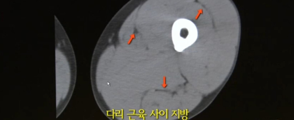 14년째 자전거로 출퇴근하는 주민센터장 | 인스티즈