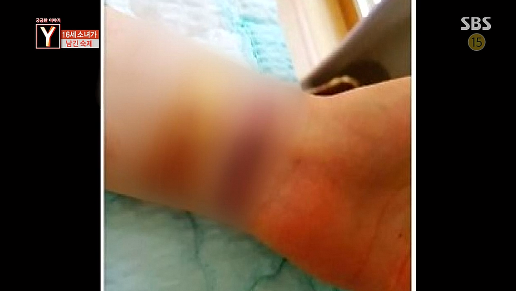 소셜미디어폭력으로 극단적인 선택을한 16세소녀 | 인스티즈