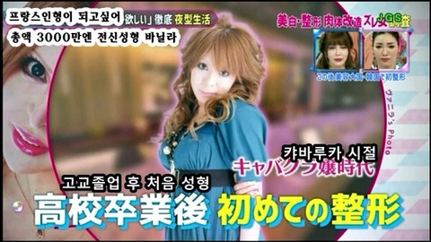 프랑스 인형이 되고싶어 총액 3000만엔 전신성형한 바닐라 | 인스티즈