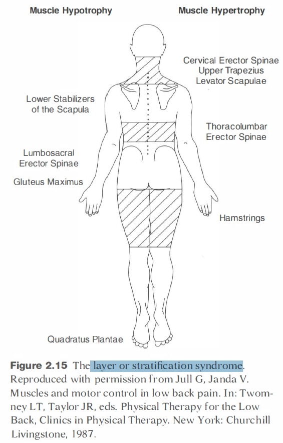 Stratification or Layer Syndrome - therapeutic exercise - 치료적 맞춤운동, 비타미네, 영성 연구소 Stratification or Layer... 
